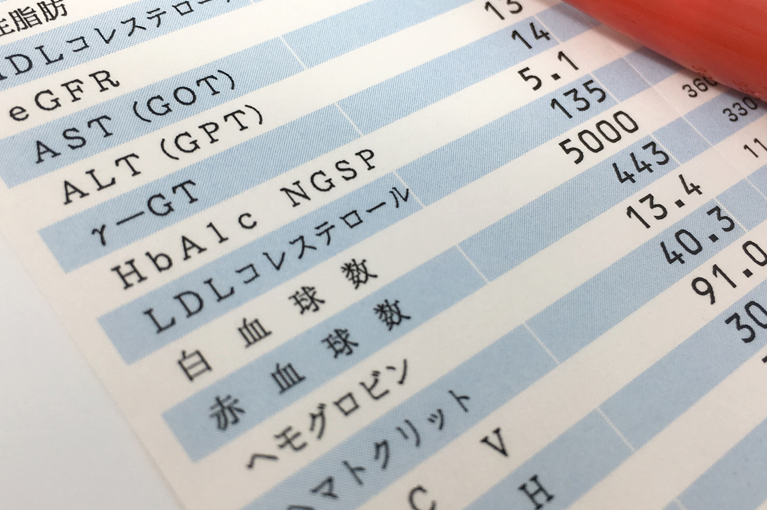 健康診断で肝機能障害を指摘されたら